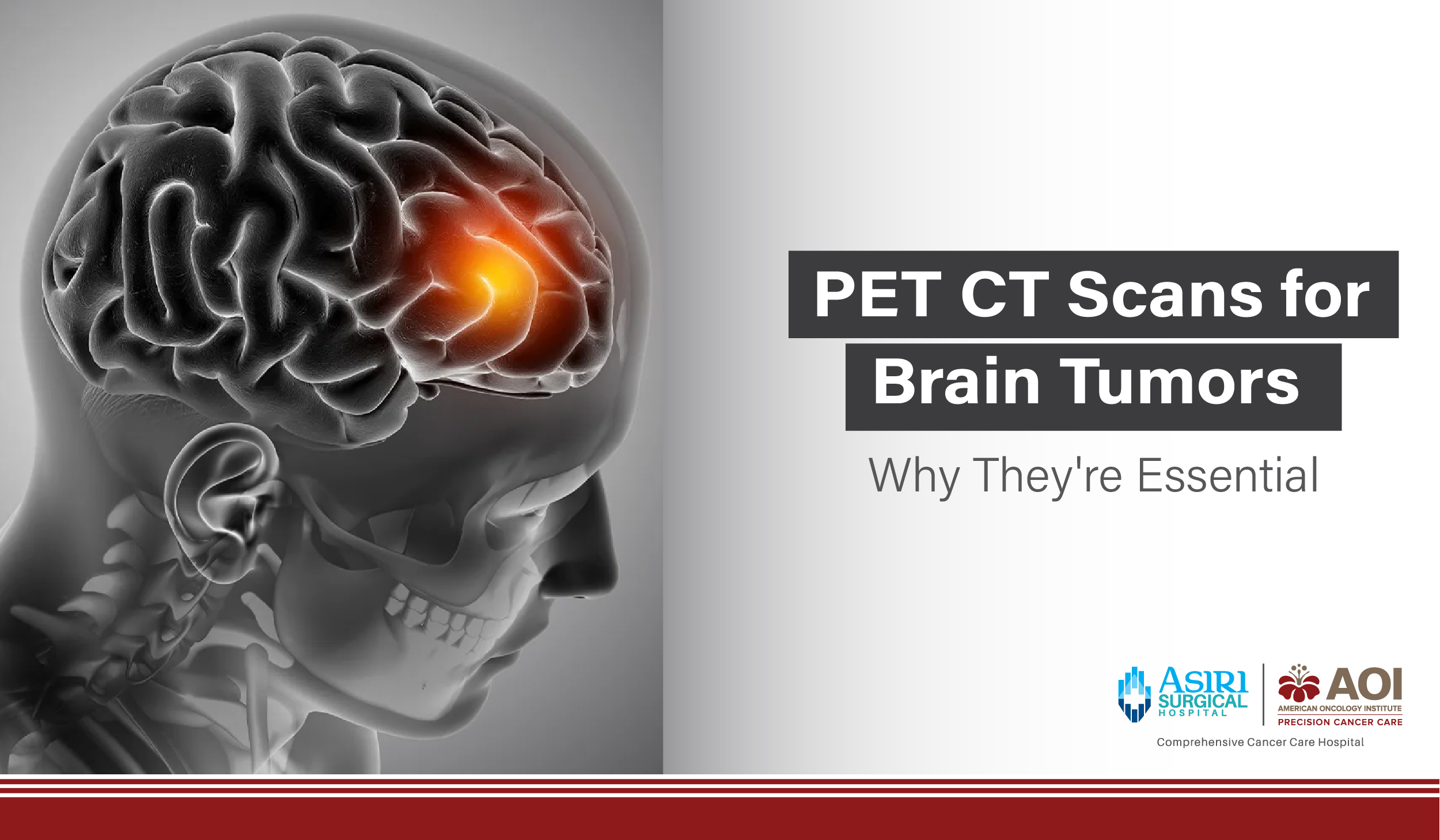 241105091128PET_CT_Scans_for_Brain_Tumors_Why_They're_Essential.jpg